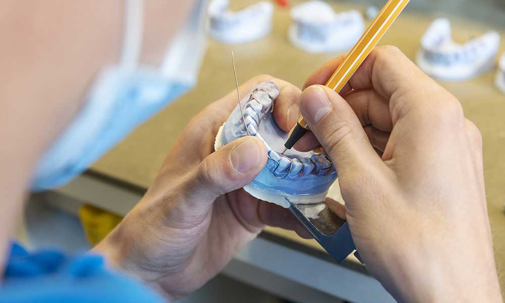MTA hält Zahnabdruck zur Anfertigung einer Zahnspange in der Hand